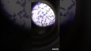 Candida albicans 100x oil immersion [upl. by Airdnax]