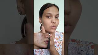 Use of Color corrector pallate 🥰 skincare skincareproducts beautytips beautyproducts shorts [upl. by Golub270]