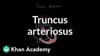 Truncus arteriosu  Circulatory System and Disease  NCLEXRN  Khan Academy [upl. by Oderfodog]