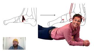 Lowman Procedure for Pes Planus [upl. by Kilian834]