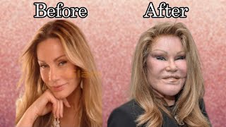 The Story Of JOSELYN WILDENSTEIN aka Cat woman  Plastic Surgery Billionaire marriage and more [upl. by Rehc]