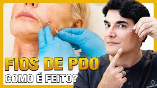 FIOS DE PDO  Como é feito [upl. by Rona945]