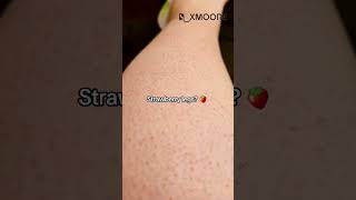 Get Rid of Strawberry Legs in 7 Days or Less Guaranteed！Rxmoore IPL hair removal skincareshaving [upl. by Lederer]