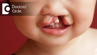 Surgeries for Cleft Lip amp Palate  Dr Srikanth V [upl. by Drazze]