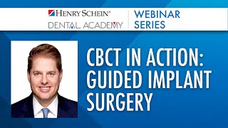 CBCT in Action Guided Implant Surgery [upl. by Ysdnyl225]