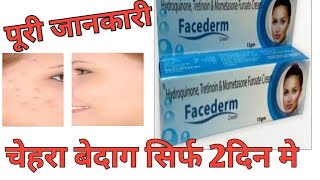 Hydroquinone Tretinoin amp Mometasone Furoate Cream Review by Guru Kirpa Clinic [upl. by Aleinad534]