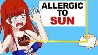 Im Allergic to Sun [upl. by Arabella359]