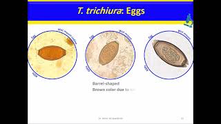 Trichuris trichiura Nematodes [upl. by Ihcekn]