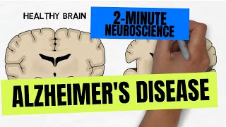 2Minute Neuroscience Alzheimers Disease [upl. by Tali]