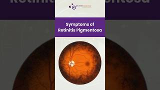 Symptoms of Retinitis Pigmentosa [upl. by Mady]