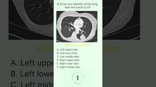 Chest Buzz 8 radiologychannel007 [upl. by Cissie]