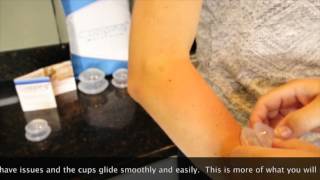 Cupping Warehouse TM Cupping Forearm with Professional Medical Supreme 4 Cupping Therapy Set [upl. by Ohnuj]