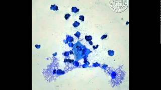 Physarum polycephalum gets the blues in time lapse [upl. by Lotsirk908]