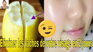 Voici Comment Utilisez le citron pour éliminer les taches de votre visage en 2 jours [upl. by Mihe]