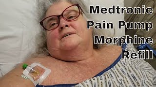 Medtronic Pain Pump  Morphine Refill  Met Virginia  Northern Lights [upl. by Sosna]