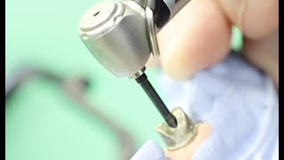 Remove a Stripped Abutment Screw in Minutes dentalimplant complications [upl. by Ahsirkal]