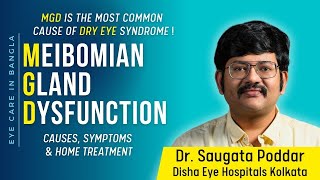 Meibomian Gland Dysfunction Causes Symptoms and remedy for dry eyes MGD by Dr Saugata Poddar [upl. by Cohl519]