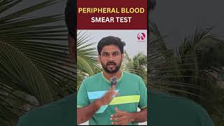 PBS  Peripheral Blood Smear Test bloodtest size shape anemia medicaltest [upl. by Akinak308]