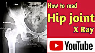 How to read Hip joint X Ray । Hip joint Anatomy । Uday Xray [upl. by Esinek]