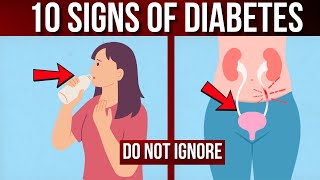 10 Signs of Diabetes A Comprehensive Guide to Identifying and Preventing It [upl. by Ayeki639]