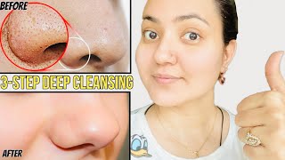 3Step Deep Cleansing Facial To Reduce PoresBlackheadsAcne ScarsPimple Marks amp Excess Oil [upl. by Trabue261]