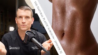 32 Everything You Need To Know About Liposuction [upl. by Thursby]