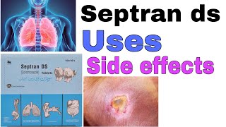 Septran ds tablets  how to use Cotrimoxazole  uses  side effects  precautions in urdi hindi [upl. by Haelak]