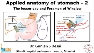 Lesser sac and foramen of Winslow  Applied anatomy of stomach part 2 [upl. by Andersen]