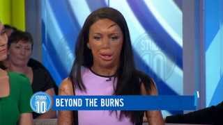 Turia Pitt Beyond The Burns  Studio 10 [upl. by Sivet473]