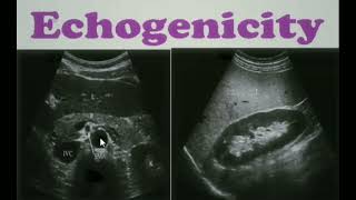 Echogenicity Ultrasound ultrasoundecgogenicity sonology [upl. by Enamrahc]