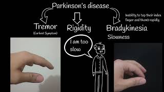 Parkinsons disease  First symptoms and treatment Parkinsons disease explained simply [upl. by Cissiee]