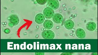 Endolimax nana visto ao microscópio óptico  identificando cistos de Endolimax nana [upl. by Enovi]