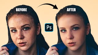 Face Retouching  Best Photoshop Tutorial  Skin Retouching 2024 [upl. by Sydel300]