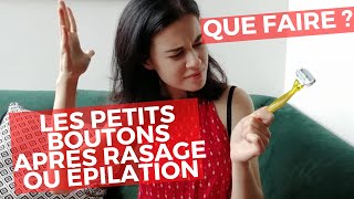 Ne plus avoir les boutons rouges après rasage ou épilation [upl. by Anselmo]