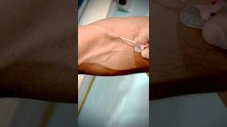 Mastering Canalization A StepbyStep Guide to Expert IV Catheterization highlight toptrending [upl. by Appel507]