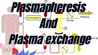 Plasmapheresis part1Plasma exchangeTherapeutic plasma exchangetherapeutic plasmapheresisTPEPE [upl. by Mychal229]