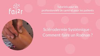 Sclérodermie Systémique  Comment faire un Rodnan [upl. by Tirreg303]