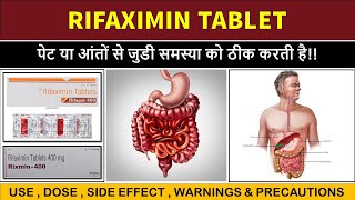 rifaximin tablets 400 mg  rifagut 400  rifaximin tablets rifagut 400 [upl. by Deery]