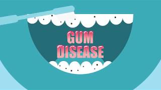 Wave goodbye to gum disease with Listerine® [upl. by Dyane]