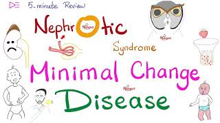 Minimal Change Disease  Nephrotic Syndrome  🖐 5Minute Review [upl. by Nnylirret]