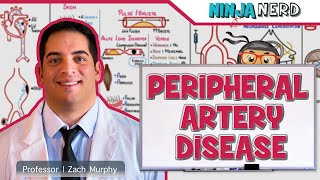 Peripheral Artery Disease [upl. by Tower]