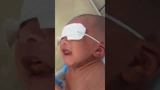 Caput succedaneum head baby newborn cute newbornbaby viralvideo babyboy [upl. by Wira]