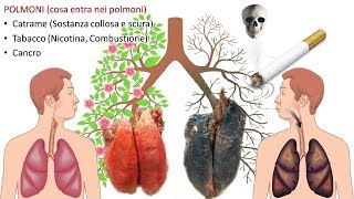 La differenza tra un polmone sano e uno di un fumatore [upl. by Anirres]