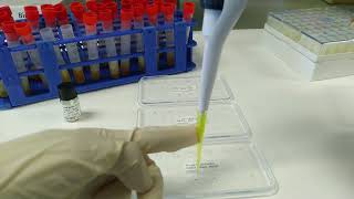 ENG SUB Immunology Radial Immunodiffusion RID test [upl. by Augusto]