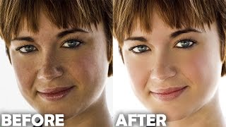 Photoshop Tutorial How to Quickly Smooth Skin and Remove Blemishes amp Scars  Part I [upl. by Mauro681]