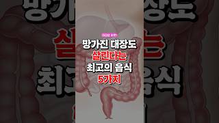 망가진 대장도 살린다는 최고의 음식 5가지 건강식 지식50대건강 대장암건강정보 [upl. by Eceinal]