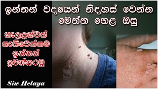 Innan sadaha prathikara  ඉන්නන් ඉවත්කරන හෙළ ඔසු  innan iwathkarana lesima krama  siw helaya [upl. by Tav56]