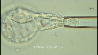 The Fertility Lab at Northwell Health Fertility [upl. by Swithbart]