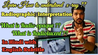 How to understand dental XRAY  Radiographic interpretation  dental radiograph [upl. by Notlrac]