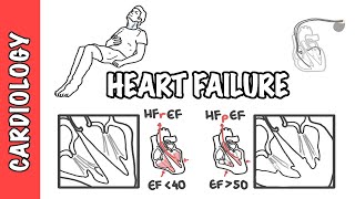 Heart failure with reduced and preserved ejection fraction pathophysiology and treatment [upl. by Barden391]